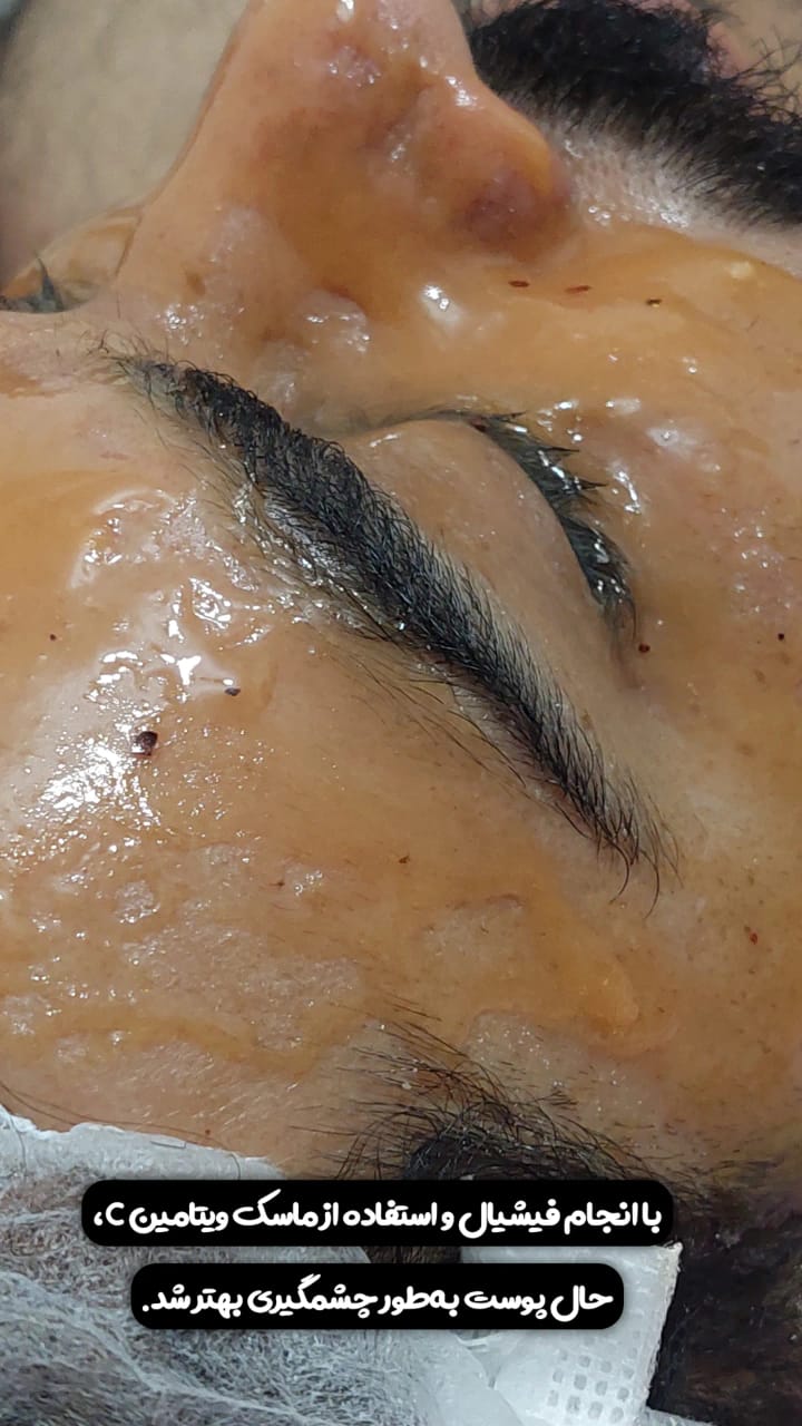 خدمات پاکسازی و درمان پوست یلدا اکبری در شیراز